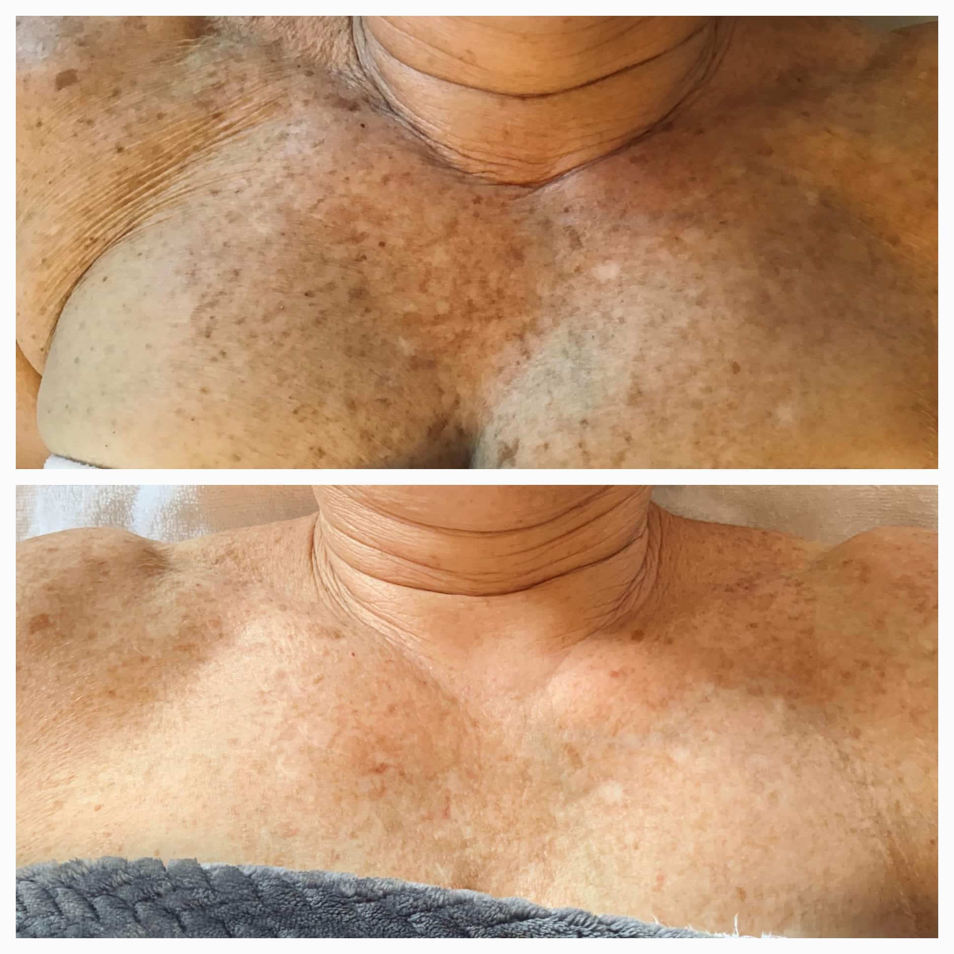 Laser Services before and after photos from Cúrate MedAesthetics in Chattanooga TN